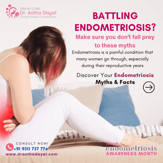 Battling endometriosis- Myths and Facts